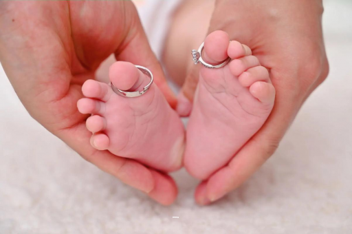 百色孕妇怎样预防妊娠纹 百色孕妇怎样预防妊娠纹